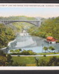 Allegheny County, Pittsburgh, Pa., Parks, City: Schenley Park, Miscellaneous Views: View of Lake and Bridge over Panther Hollow